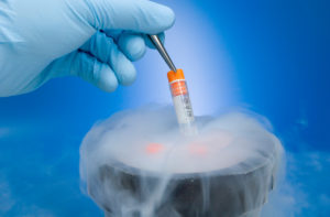 biological sample being removed from liquid nitrogen